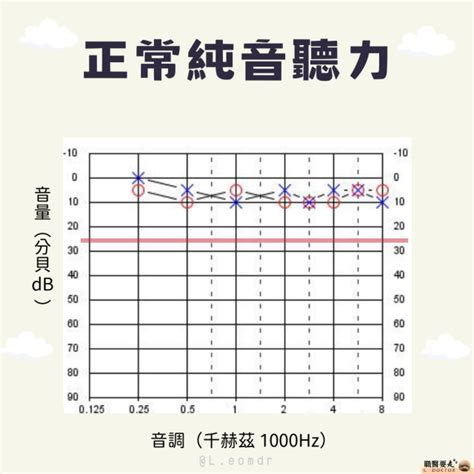 噪音符號|聽力圖判讀：基礎篇 – 職醫要走